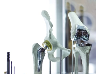 Созданное Росатомом аддитивное производство для восстановления костей поможет онкологам